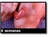 Foto de um aborto - 8 semanas