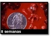 Foto de um aborto - 8 semanas